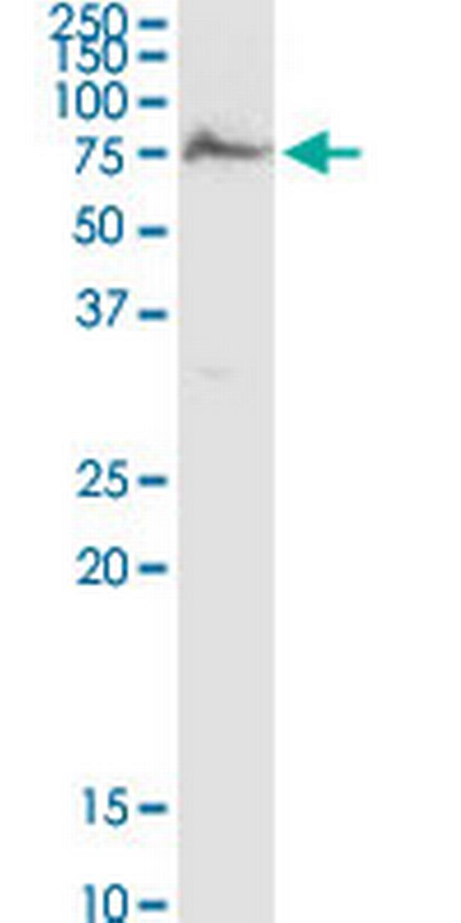 AK5 Antibody in Western Blot (WB)