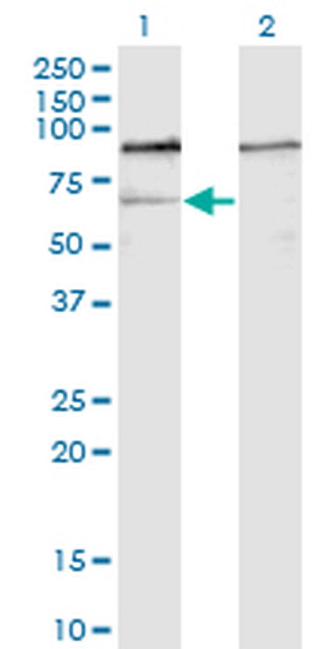 GNL3 Antibody in Western Blot (WB)