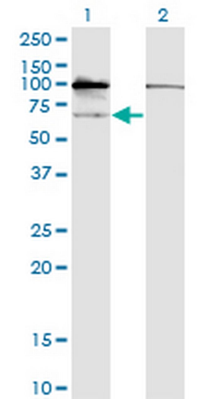 GNL3 Antibody in Western Blot (WB)