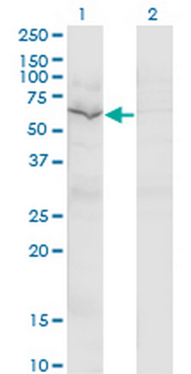 GNL3 Antibody in Western Blot (WB)