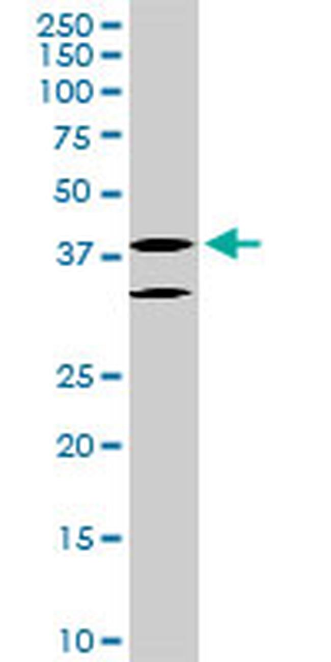 LHX6 Antibody in Western Blot (WB)