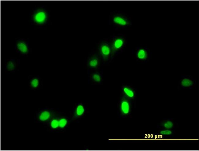 AATF Antibody in Immunocytochemistry (ICC/IF)