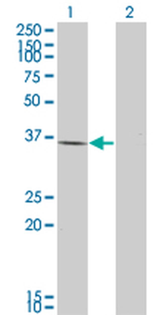 HAVCR1 Antibody in Western Blot (WB)