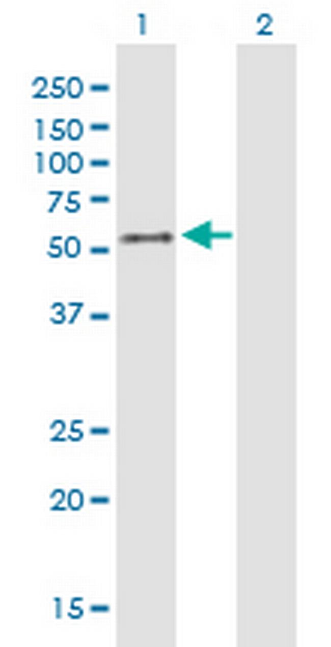 HAVCR1 Antibody in Western Blot (WB)