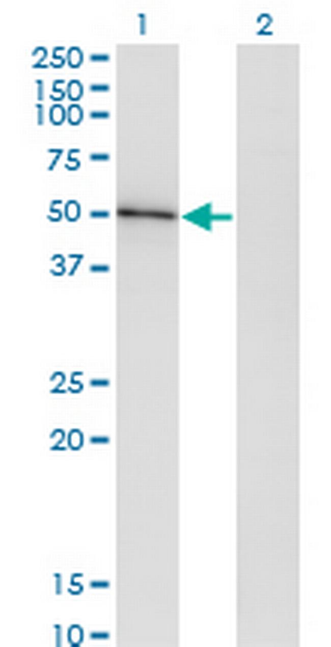 HAVCR1 Antibody in Western Blot (WB)