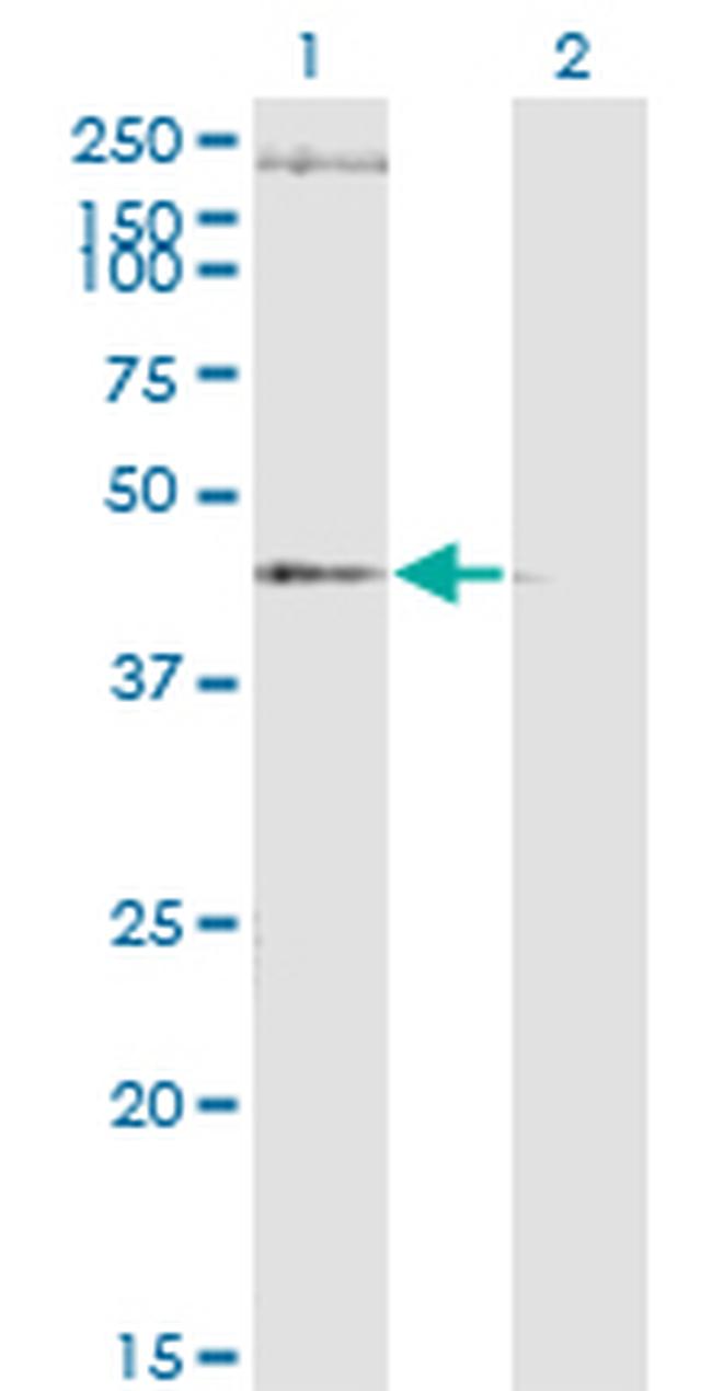 STEAP1 Antibody in Western Blot (WB)