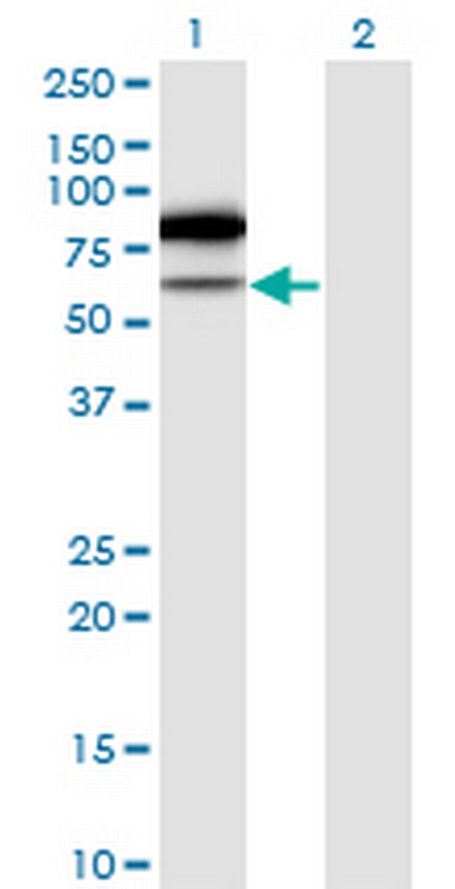 TRMT2A Antibody in Western Blot (WB)