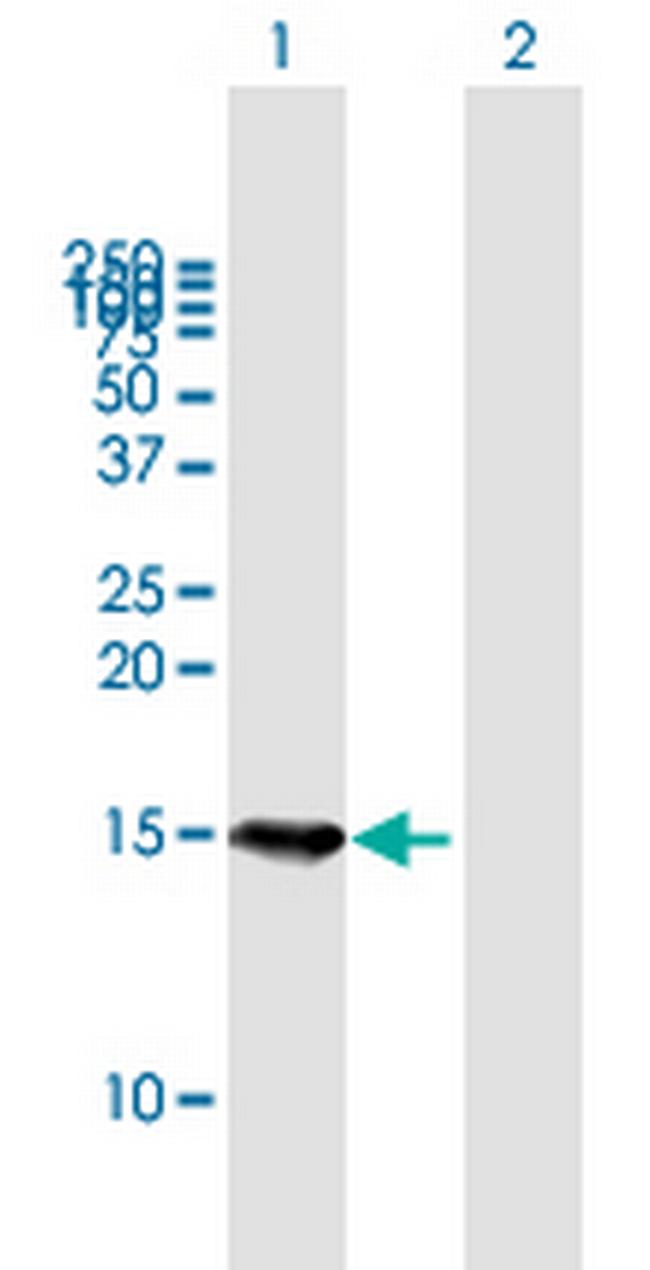 B9D1 Antibody in Western Blot (WB)