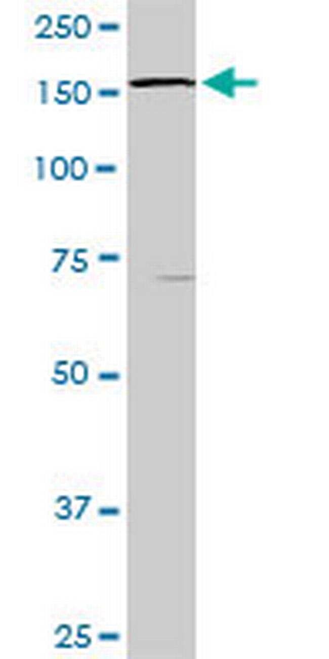 STK36 Antibody in Western Blot (WB)