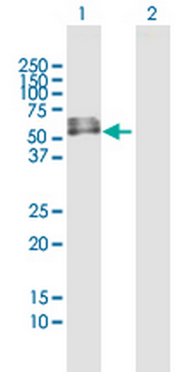 INTU Antibody in Western Blot (WB)