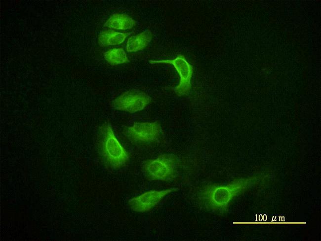 EIF2C2 Antibody in Immunocytochemistry (ICC/IF)