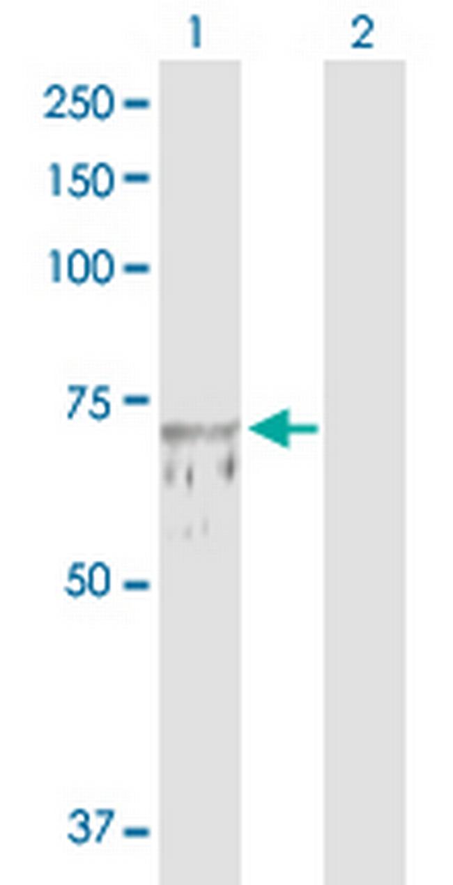 TUBGCP4 Antibody in Western Blot (WB)