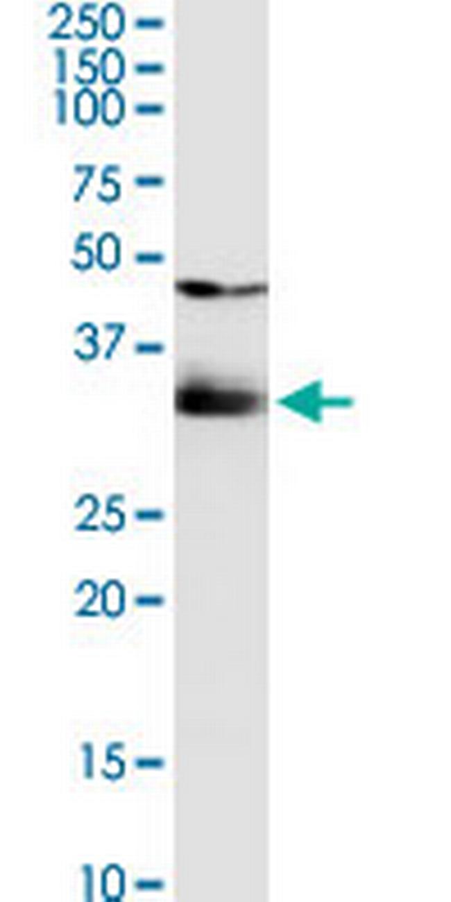 SULT1B1 Antibody in Western Blot (WB)