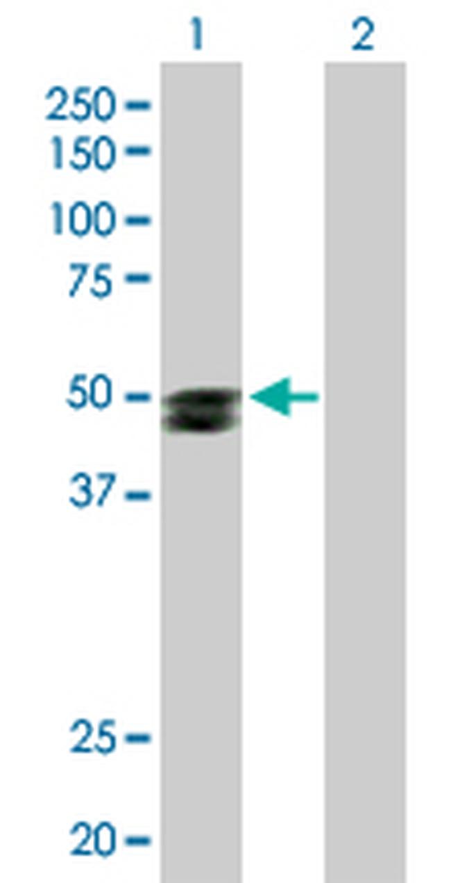 SMPDL3B Antibody in Western Blot (WB)