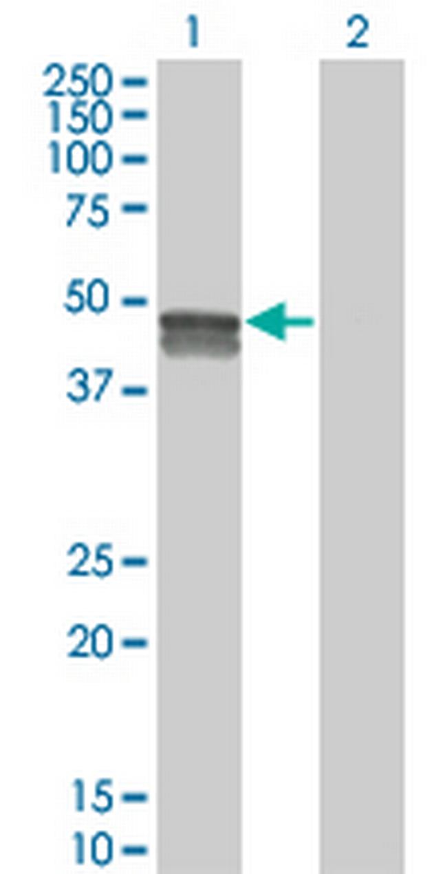 SMPDL3B Antibody in Western Blot (WB)