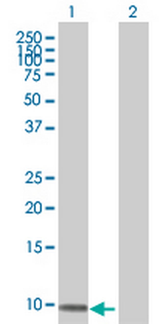 ZNF544 Antibody in Western Blot (WB)