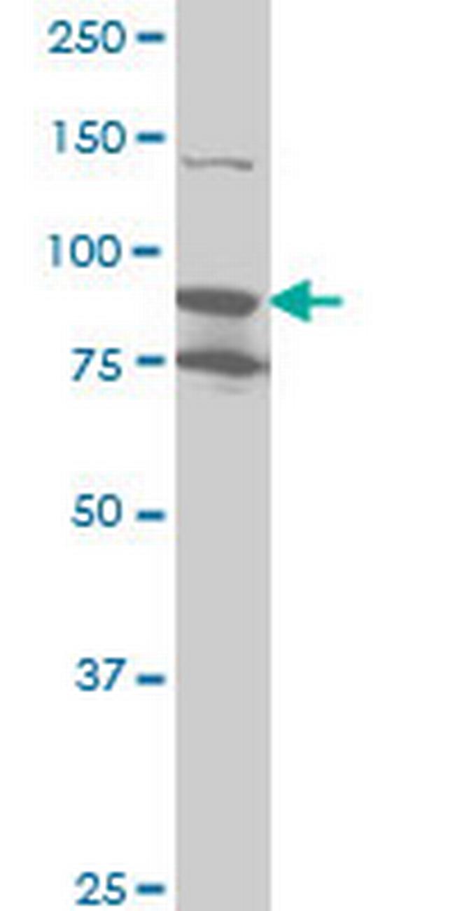 RPS6KA6 Antibody in Western Blot (WB)