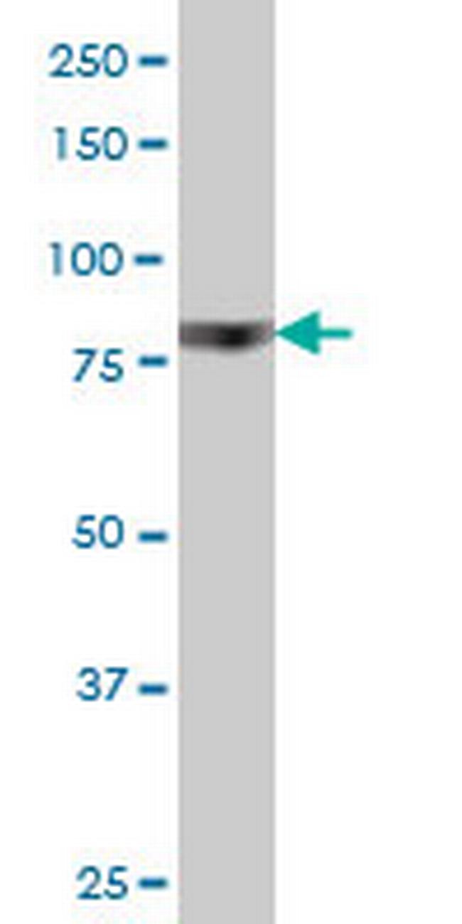 RPS6KA6 Antibody in Western Blot (WB)