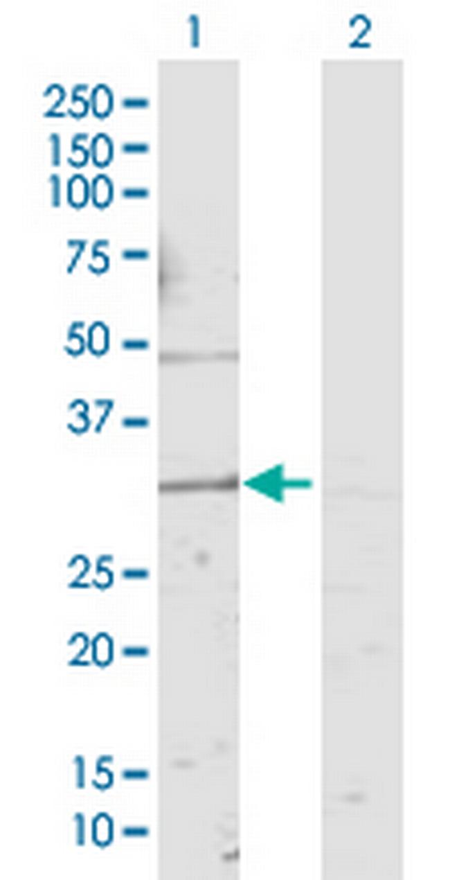 KCNMB4 Antibody in Western Blot (WB)