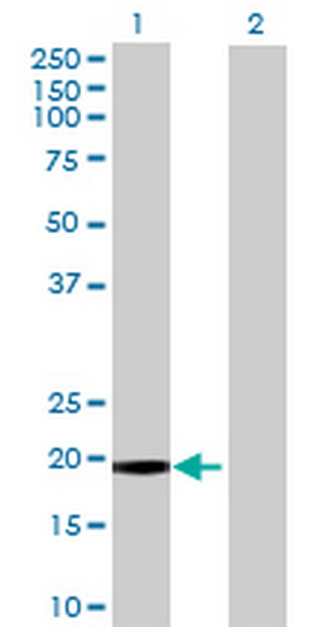 MT Antibody in Western Blot (WB)