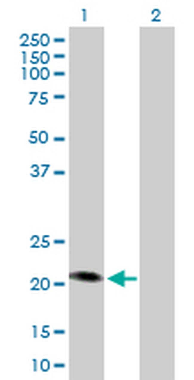 MCAT Antibody in Western Blot (WB)