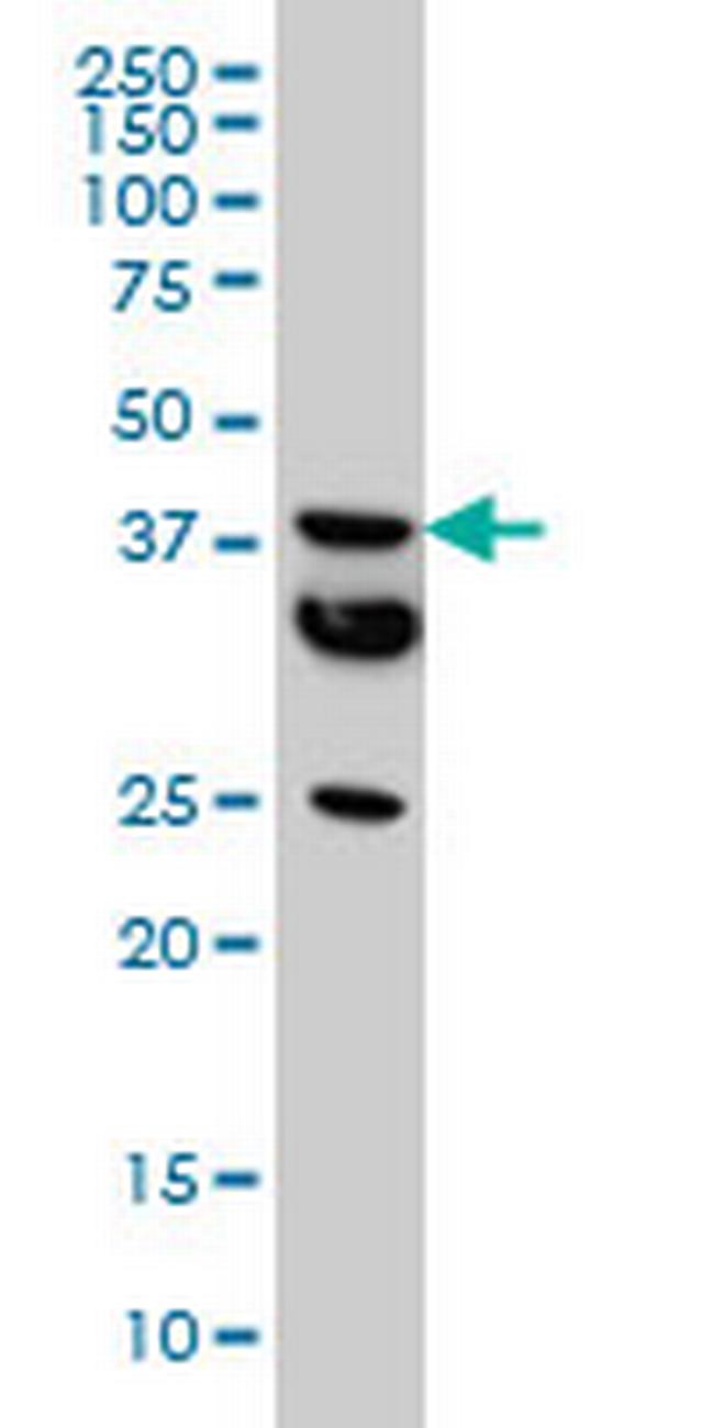 MT Antibody in Western Blot (WB)