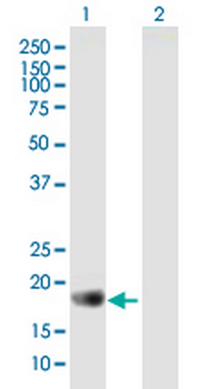 APOBEC3C Antibody in Western Blot (WB)