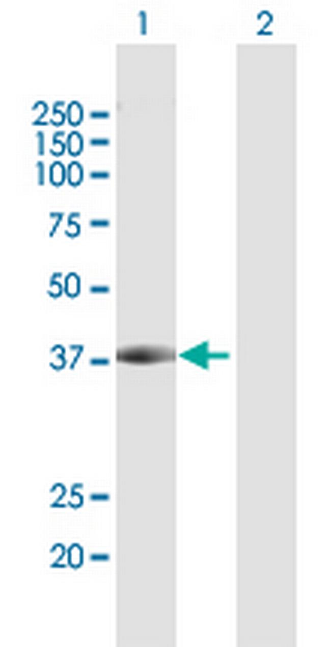 DCPS Antibody in Western Blot (WB)