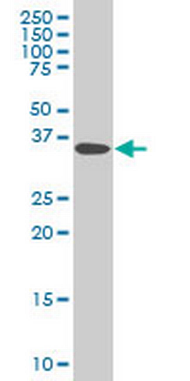 DCPS Antibody in Western Blot (WB)