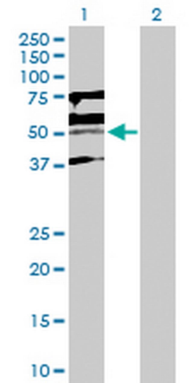 KLF15 Antibody in Western Blot (WB)