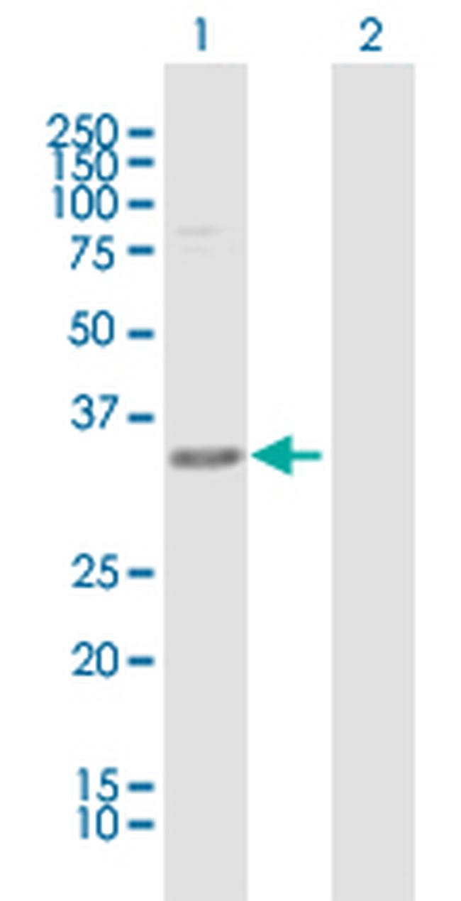 C1GALT1C1 Antibody in Western Blot (WB)