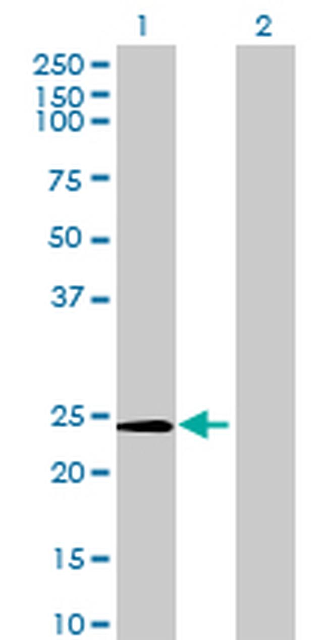 METTL5 Antibody in Western Blot (WB)