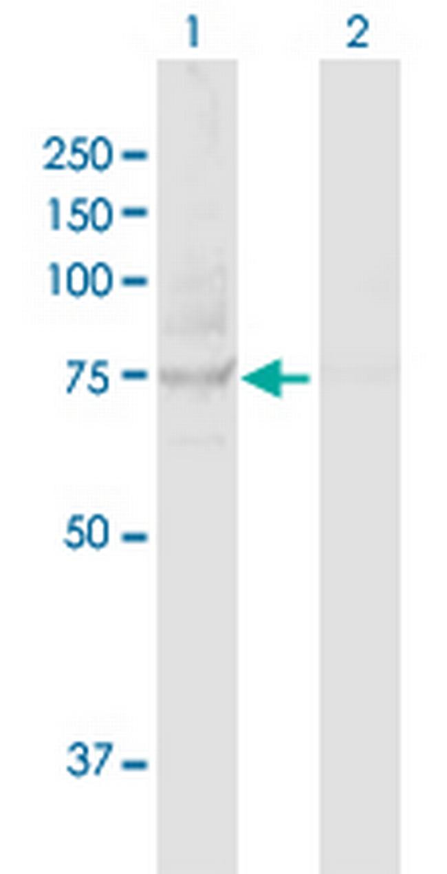 TBK1 Antibody in Western Blot (WB)