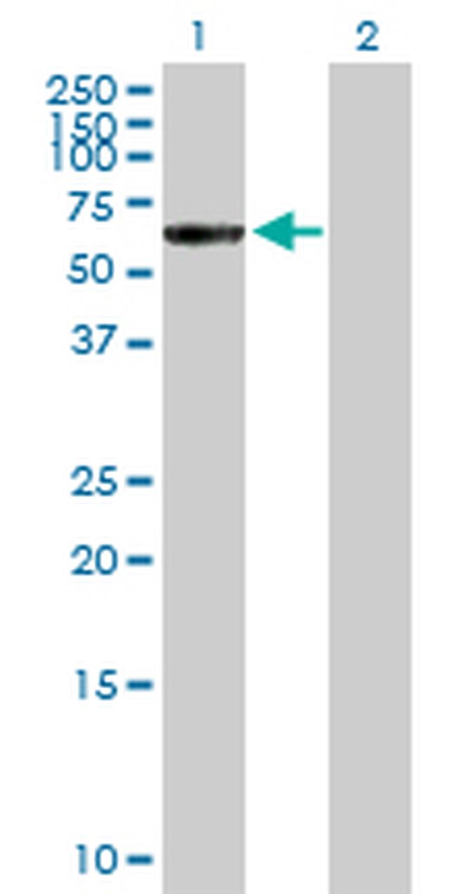 CTNNA3 Antibody in Western Blot (WB)