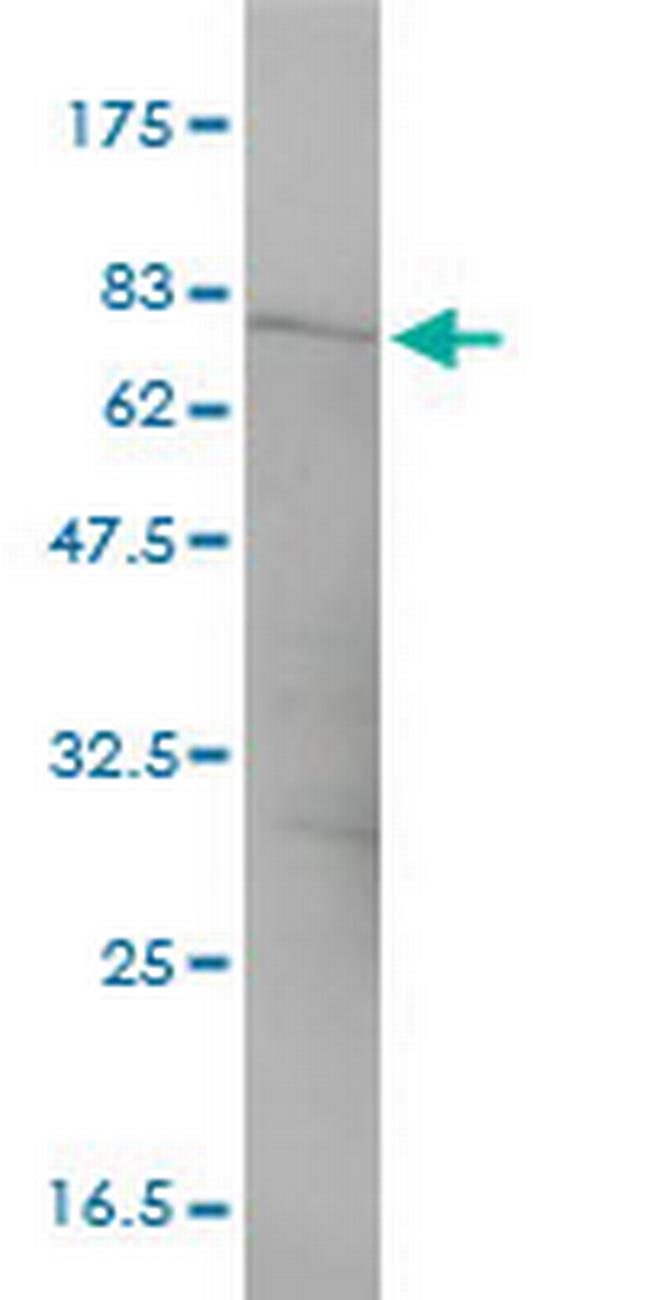 CTNNA3 Antibody in Western Blot (WB)