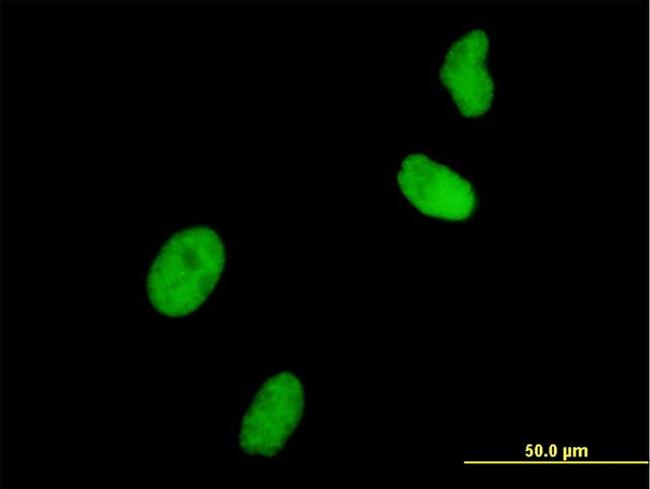 UHRF1 Antibody in Immunocytochemistry (ICC/IF)