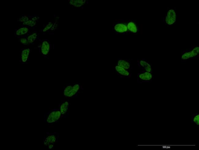 UHRF1 Antibody in Immunocytochemistry (ICC/IF)