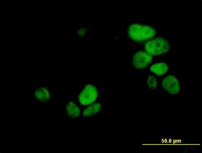 UHRF1 Antibody in Immunocytochemistry (ICC/IF)