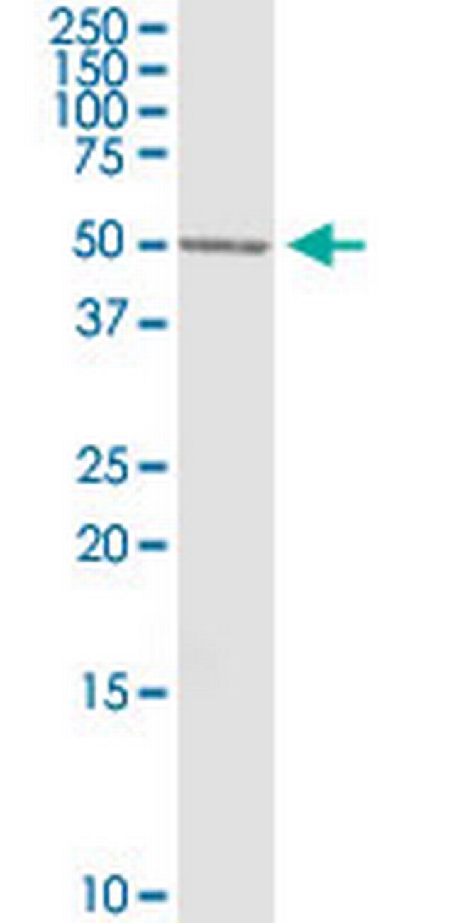 BLNK Antibody in Western Blot (WB)