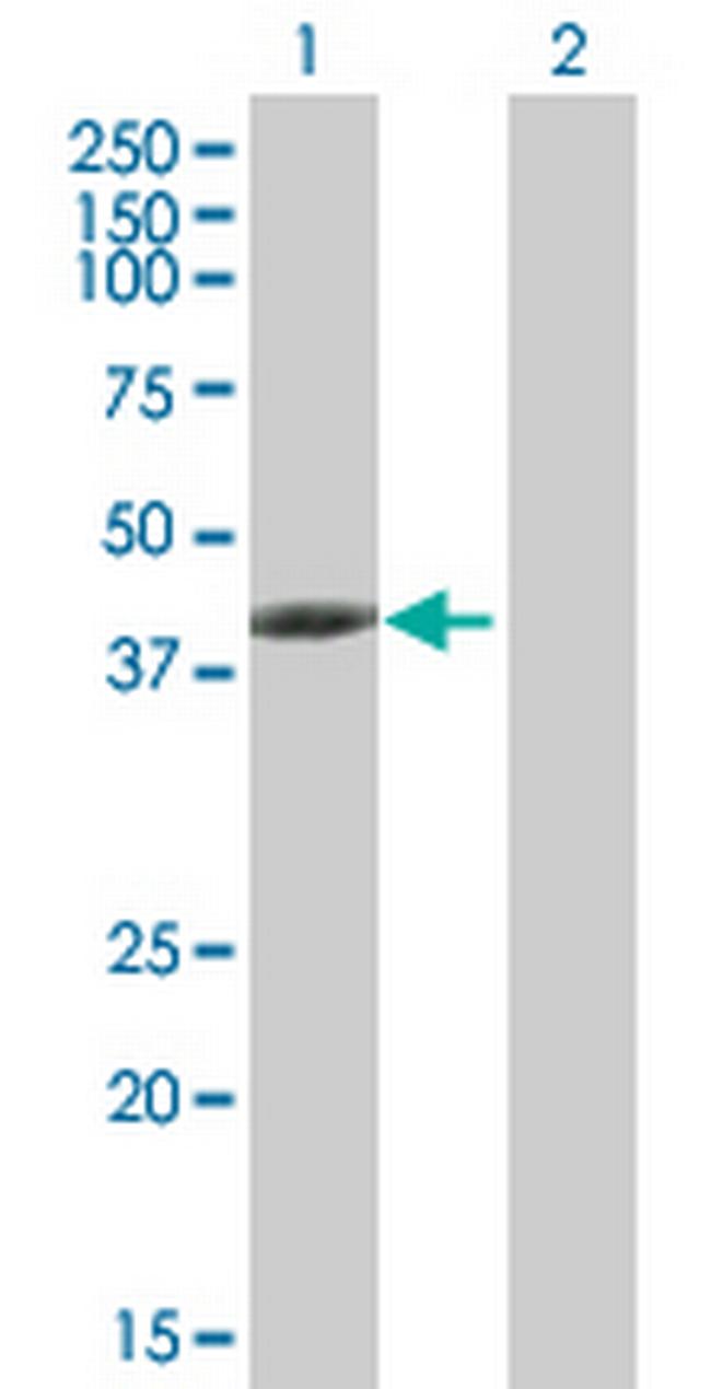 TMOD3 Antibody in Western Blot (WB)