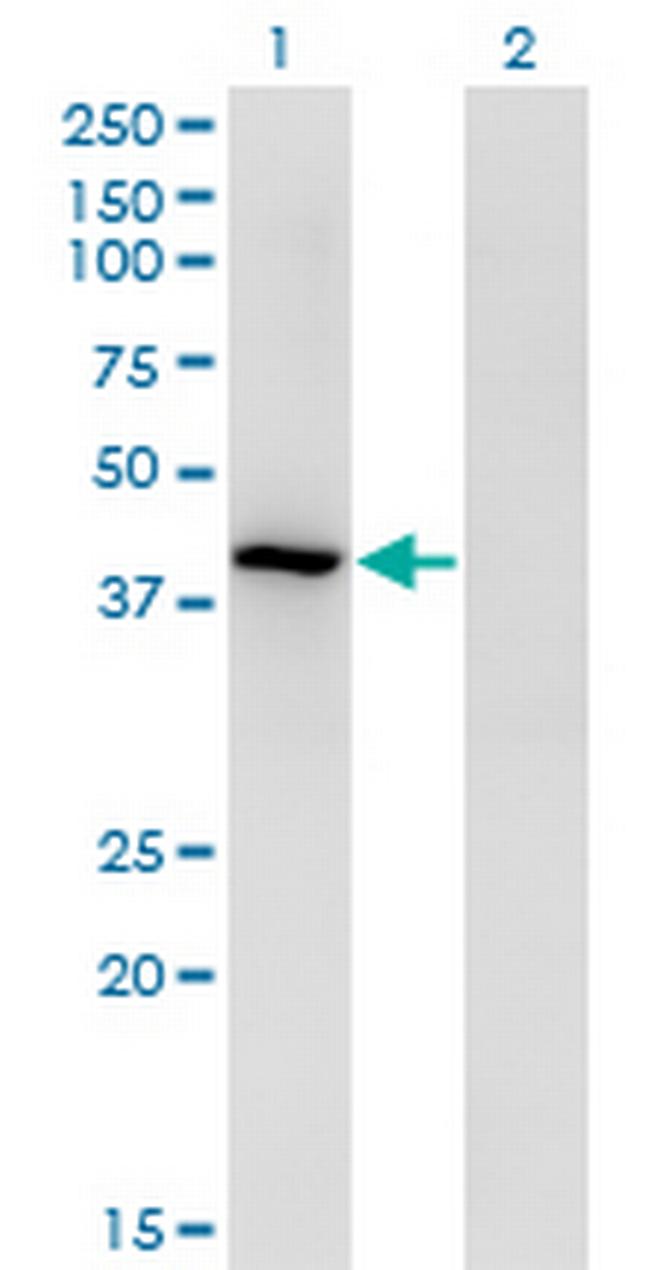 TMOD3 Antibody in Western Blot (WB)