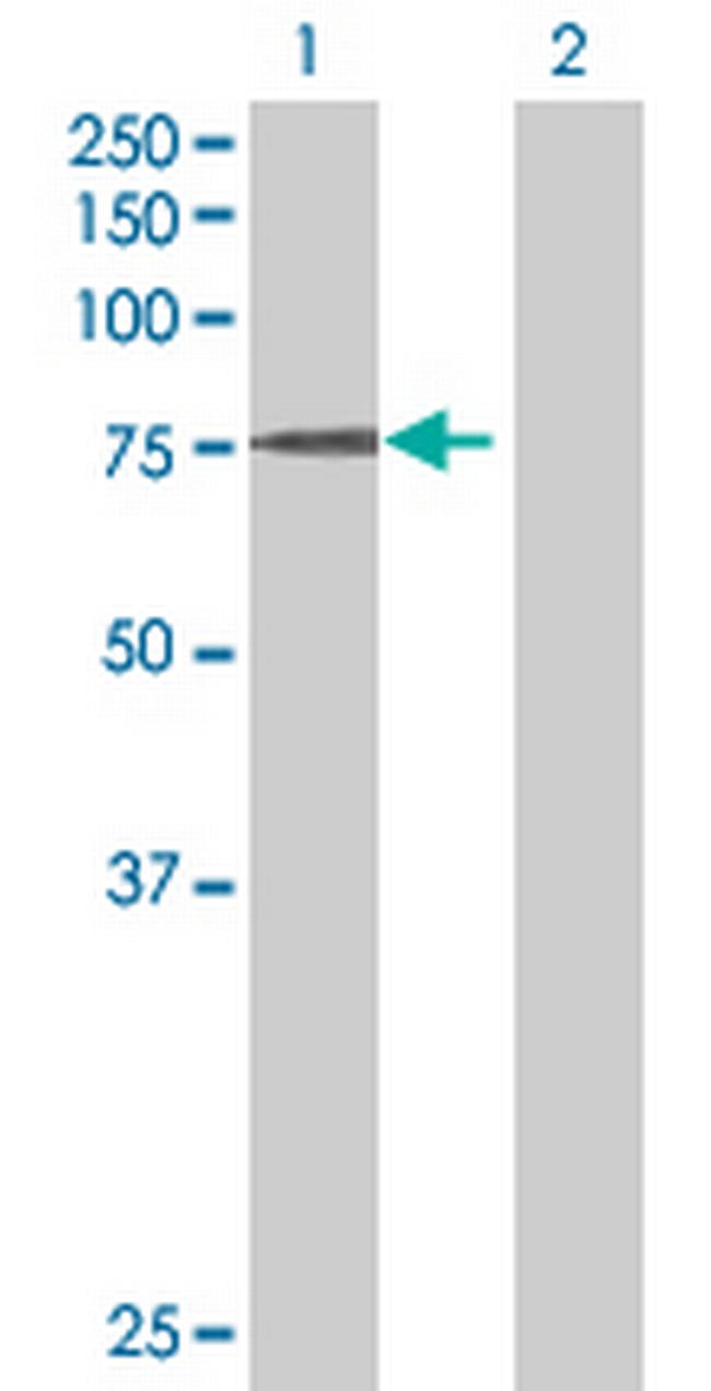 SENP1 Antibody in Western Blot (WB)