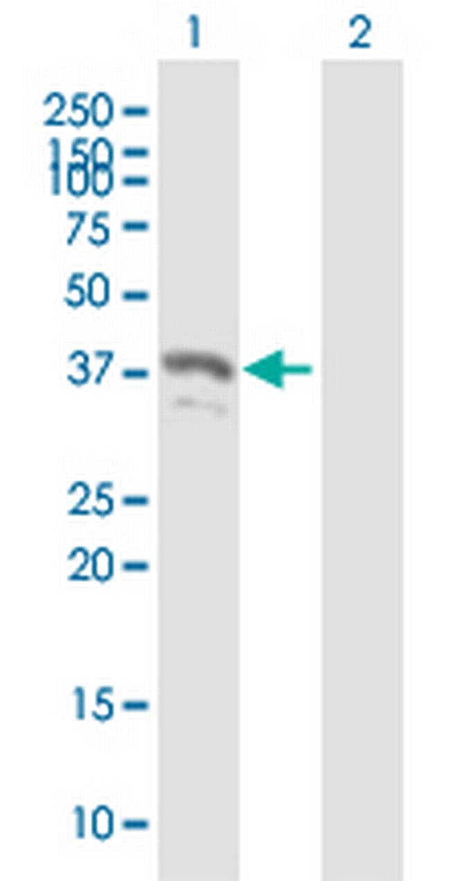 PYCR2 Antibody in Western Blot (WB)