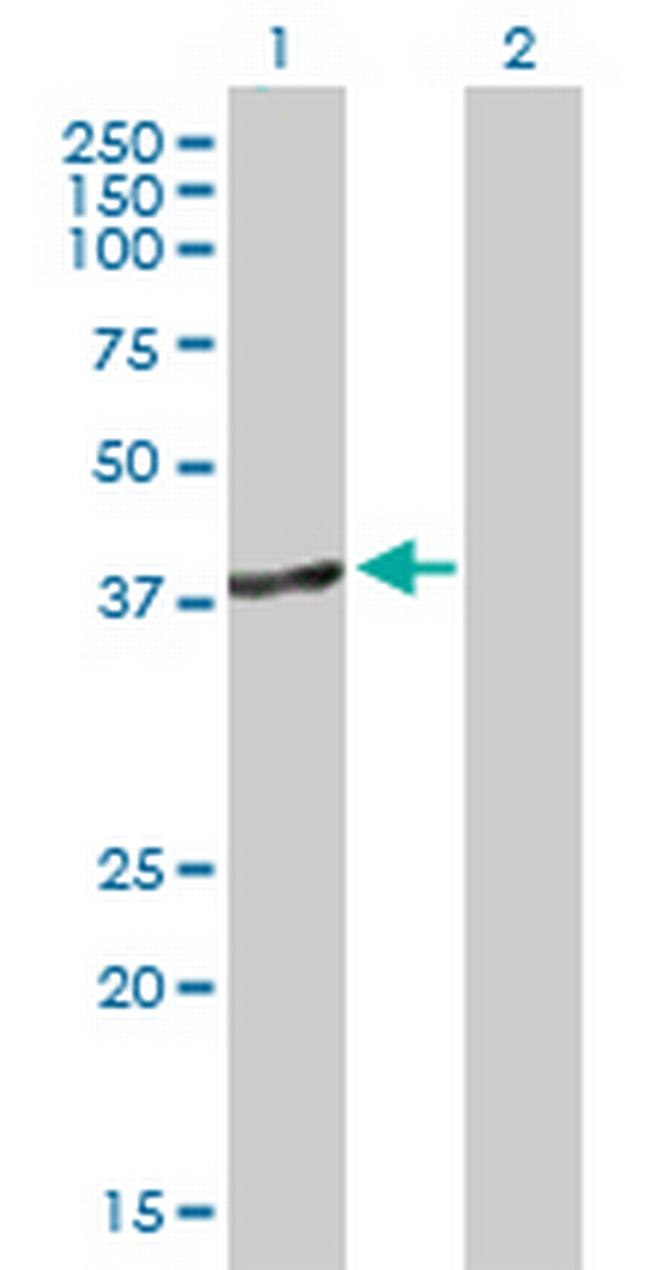 DNMT3L Antibody in Western Blot (WB)