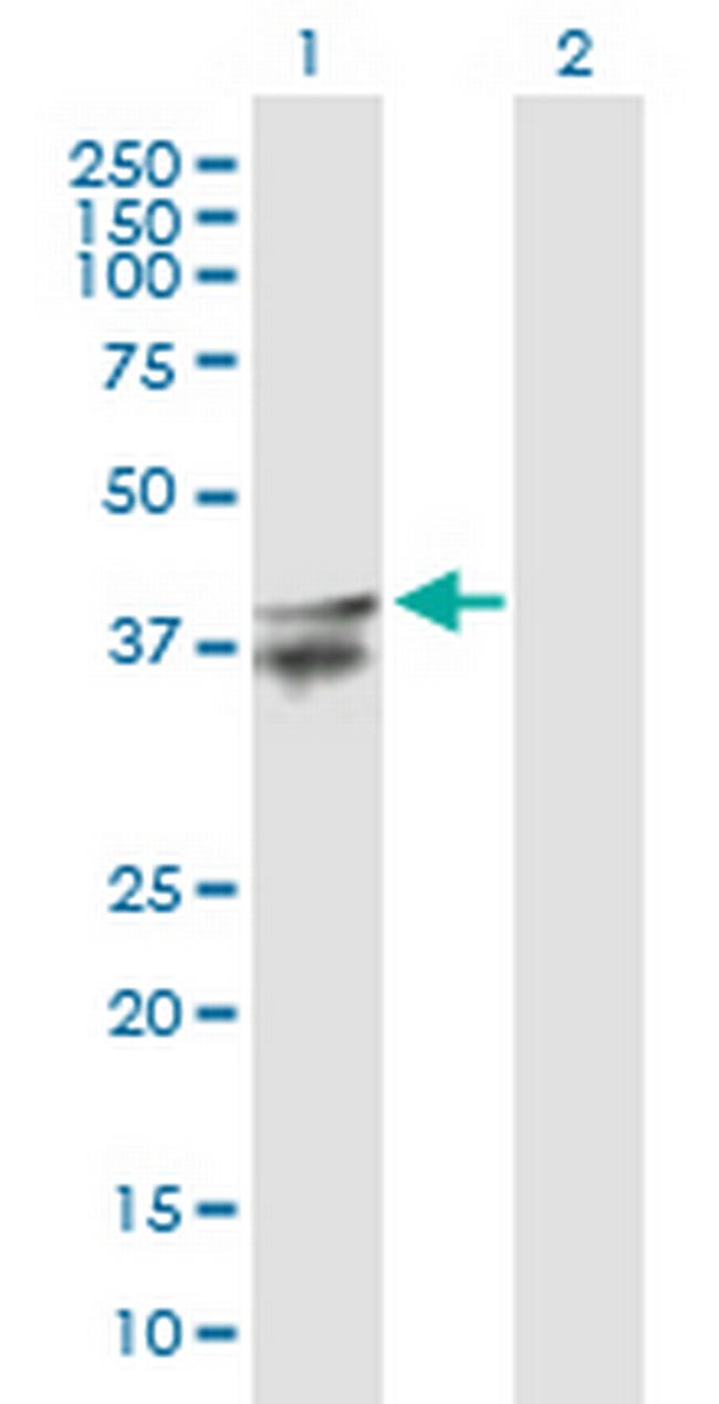 LASS2 Antibody in Western Blot (WB)