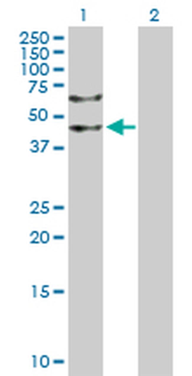 LASS2 Antibody in Western Blot (WB)