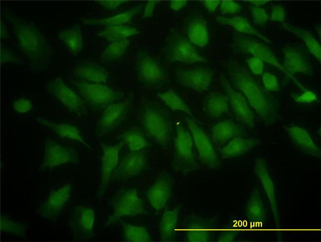 PIK3R4 Antibody in Immunocytochemistry (ICC/IF)