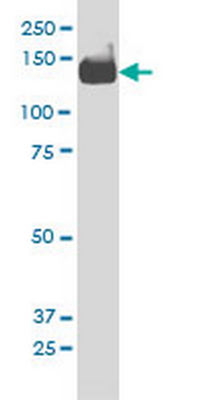 PIK3R4 Antibody in Western Blot (WB)