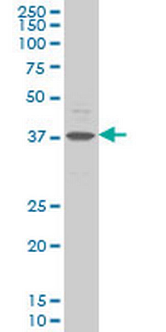 CHST11 Antibody in Western Blot (WB)