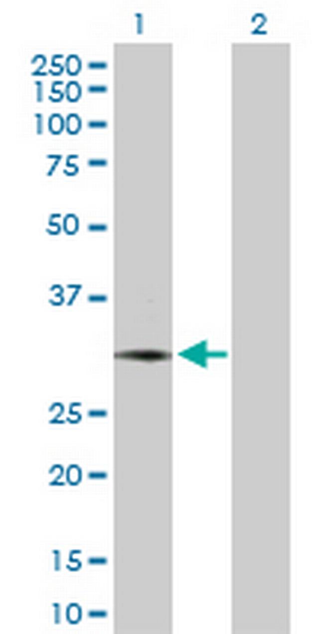 NEUROG3 Antibody in Western Blot (WB)